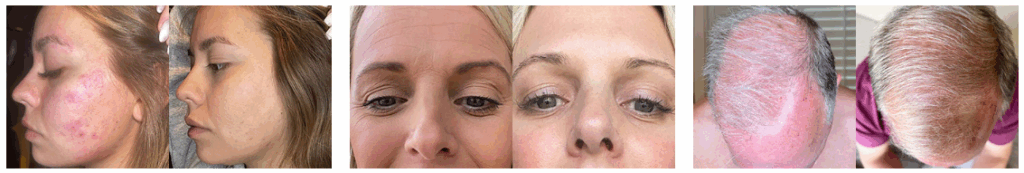bella grace results review